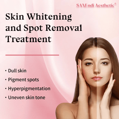 Skin Whitening and Spot Removal Treatment