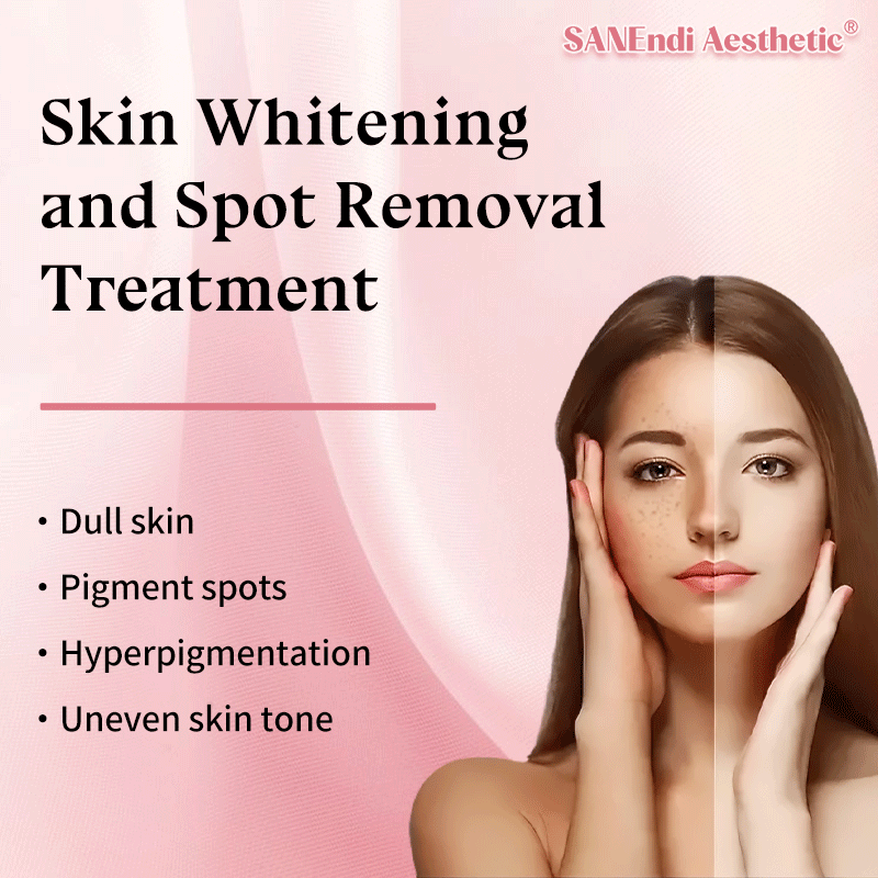 Skin Whitening and Spot Removal Treatment