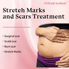 Stretch Marks & Scars Treatment